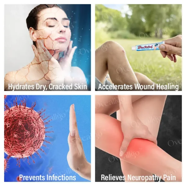 Oveallgo® DiaRelief Moisture Cream