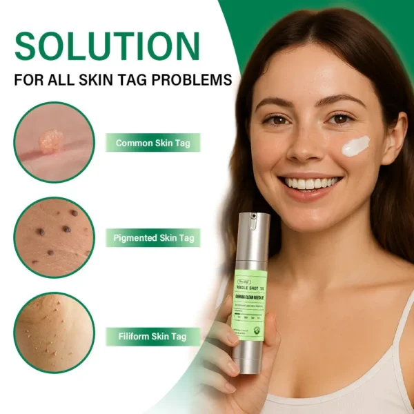 Oveallgo® Korean DermaClear Reedle Shot 100 Wart & Mole Eraser Serum