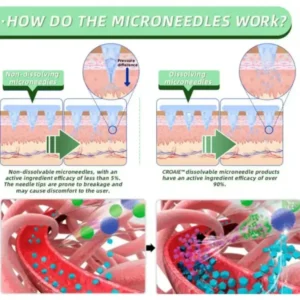 Oveallgo® SMGT-GLP-1 Nano Microneedle Patch