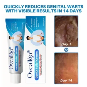 Oveallgo® HPV Genital Warts Relief Cream Pro