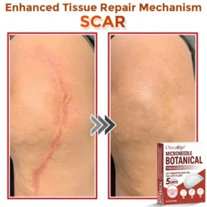 Oveallgo® Intensive MicroNeedle Botanical Tag-Clear Patch 🇺🇸 Made in the USA