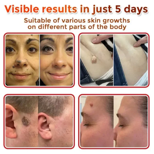 Oveallgo® MicroNeedle Botanical Tag-Clear Patch 🇺🇸 Made in the USA
