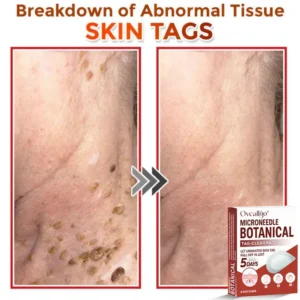 Oveallgo® MicroNeedle Botanical Tag-Clear Patch 🇺🇸 Made in the USA