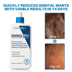 Oveallgo® NanoLipo Advanced HPV Genital Warts Eraser Cream