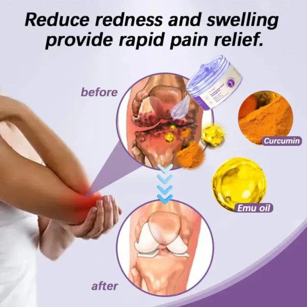 Oveallgo® Turmeric & Emu Oil Arthritis Soothing Pain Relief Massage Gel 👨‍⚕️Australian Osteopathic Association （AOA）Approved