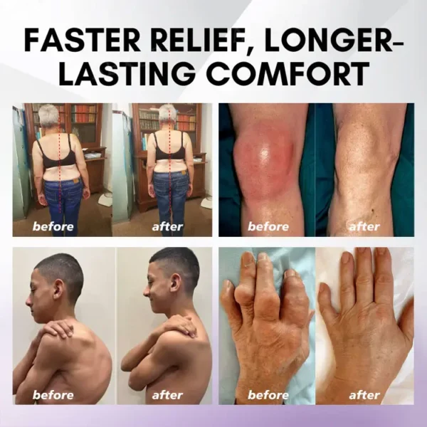 Oveallgo® Turmeric & Emu Oil Arthritis Soothing Pain Relief Massage Gel 👨‍⚕️Australian Osteopathic Association （AOA）Approved