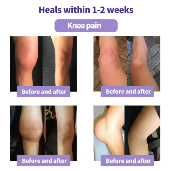 Oveallgo® Turmeric & Emu Oil Arthritis Soothing Pain Relief Massage Gel 👨‍⚕️Australian Osteopathic Association （AOA）Approved