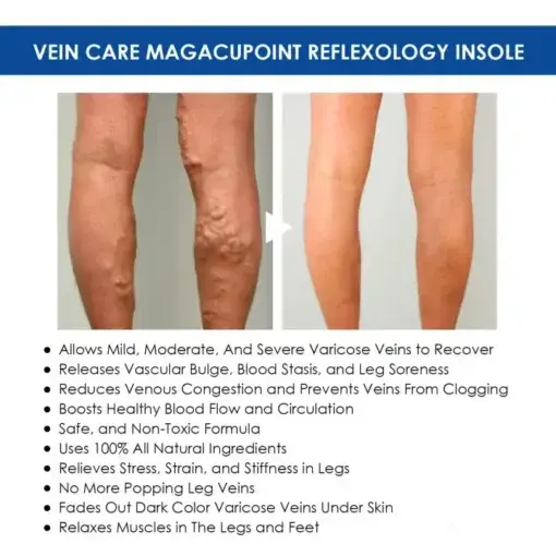 Oveallgo™ VeinCare MagAcupoint Reflexology Insole
