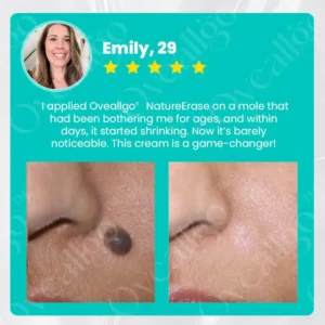 ✅ Official Store: Oveallgo® NatureErase Promax Instant Mole & Spot Removal Gel