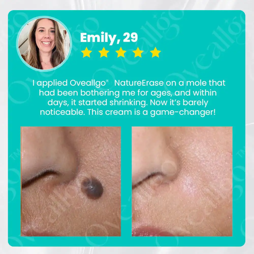✅ Official Store: Oveallgo® NatureErase Promax Instant Mole & Spot Removal Gel