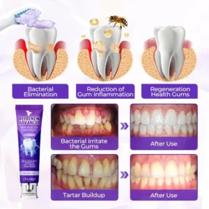 Oveallgo® BeeRenew Advanced Gum Healing Toothpaste