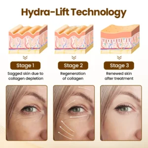 Oveallgo® Liftora 10s Wrinkle Serum