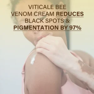 Oveallgo® VitiClear Bee Venom Cream Pro+