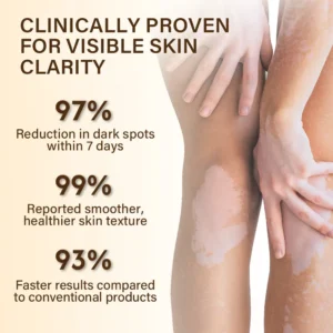 Oveallgo® VitiClear Bee Venom Cream Pro+