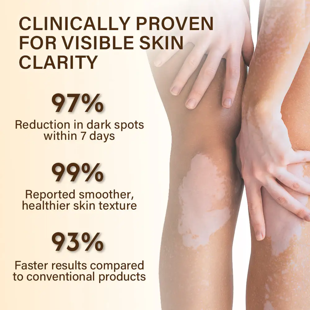 Oveallgo® VitiClear Bee Venom Cream Pro+