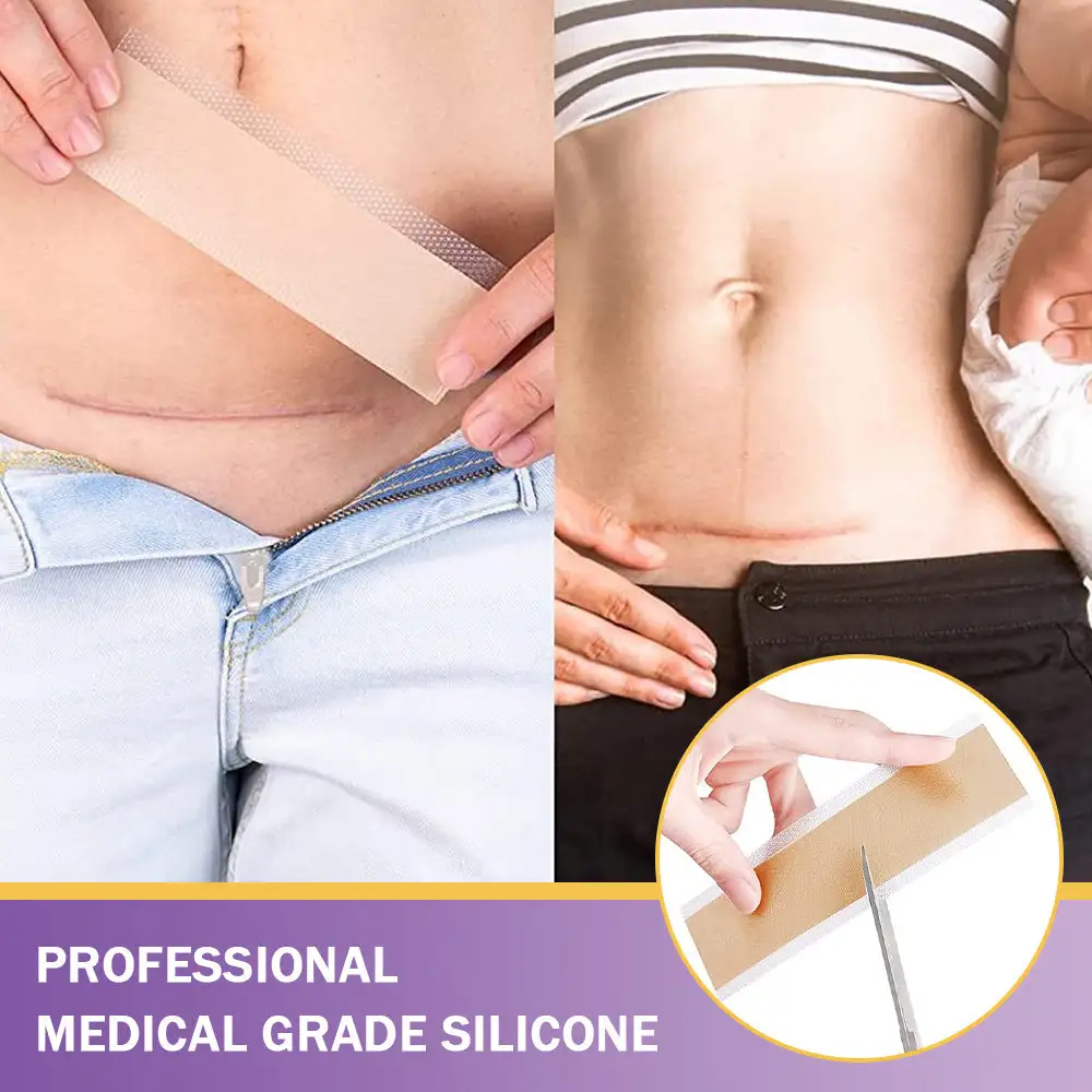 ✅Heal, Smooth & Restore – OVEALLGO® Nano Microneedle Repair Patch for All Skin Scars