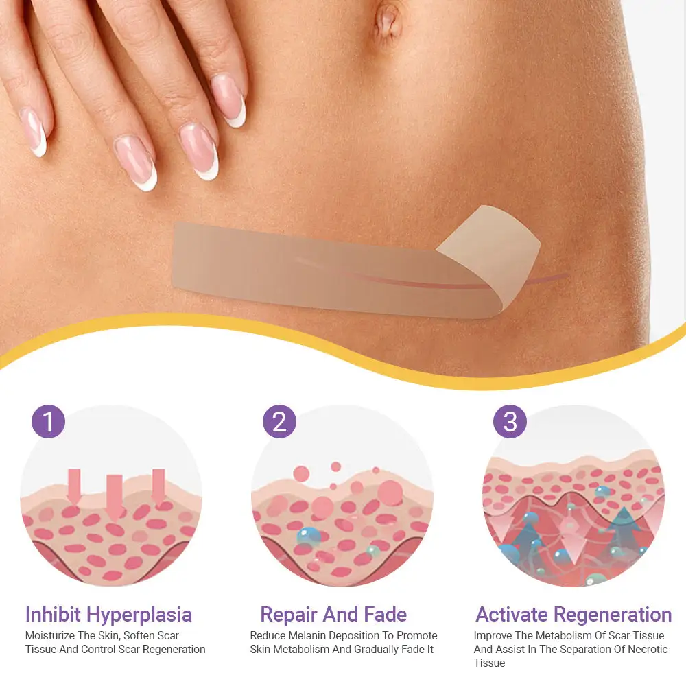 ✅Heal, Smooth & Restore – OVEALLGO® Nano Microneedle Repair Patch for All Skin Scars
