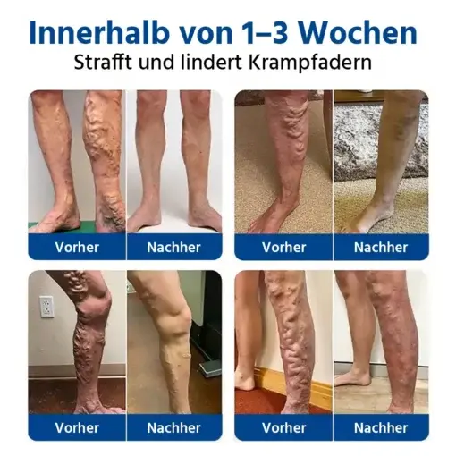 Oveallgoยฎ ๐๐๐ข๐ง๐๐๐ซ๐ ๐๐ญ ๐๐ข๐๐ซ๐จ๐ง๐๐๐๐ฅ๐ ๐๐๐ญ๐๐ก