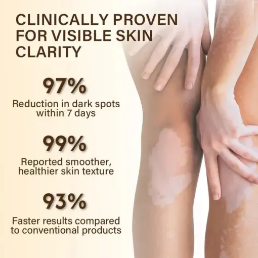 Oveallgo® VitiClear Bee Venom Cream Ultra